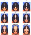HairLoss.jpeg