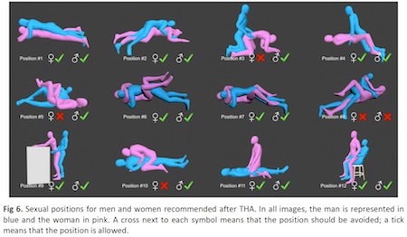 hip-positions-chart